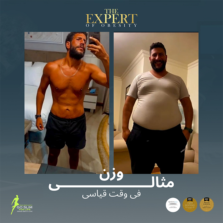 after-before-1