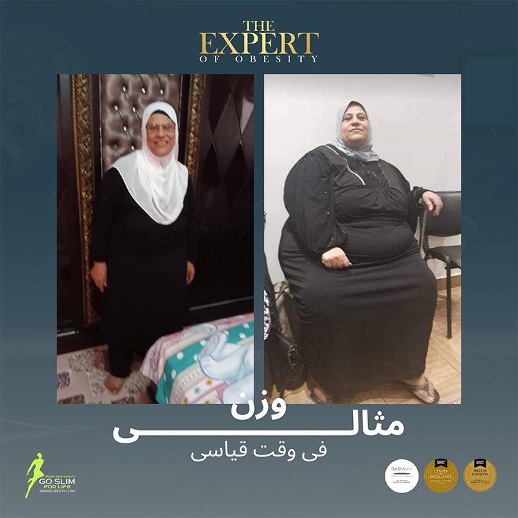 after-before-5